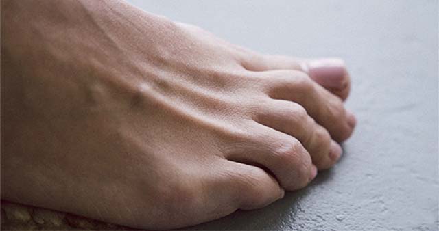 ayak parmağı şişmesi